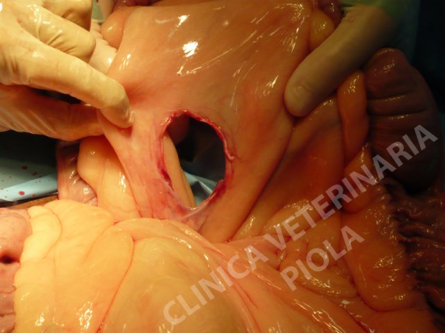 Lacerazione del mesocolon